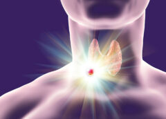 Όσα πρέπει να ξέρετε για τους όζους θυρεοειδούς: Τα συμπτώματα και οι πιθανές αιτίες